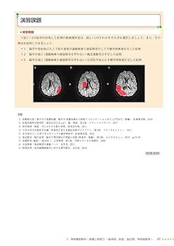 最新理学療法学講座 中枢神経系理学療法学 最新理学療法学講座 中枢神経系理学療法学/医歯薬出版株式会社